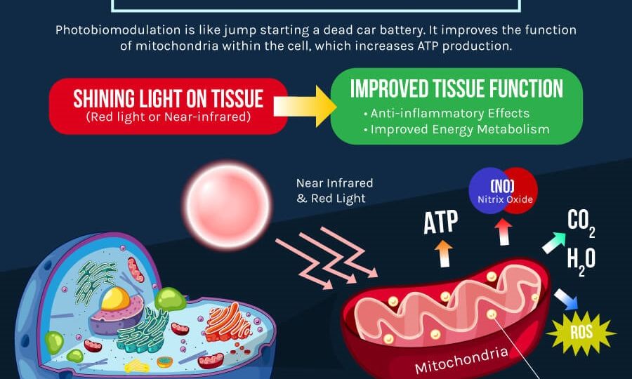 photobiomodulation-1