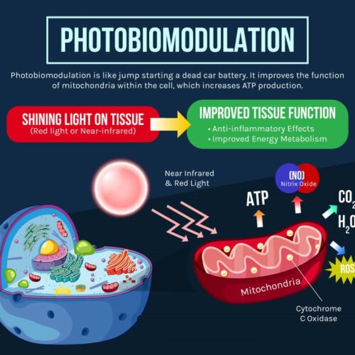 photobiomodulation-1